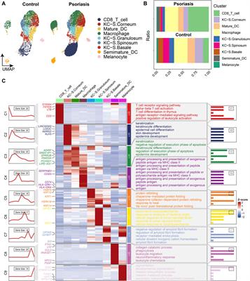 Single-cell analysis and machine learning identify psoriasis-associated CD8+ T cells serve as biomarker for psoriasis